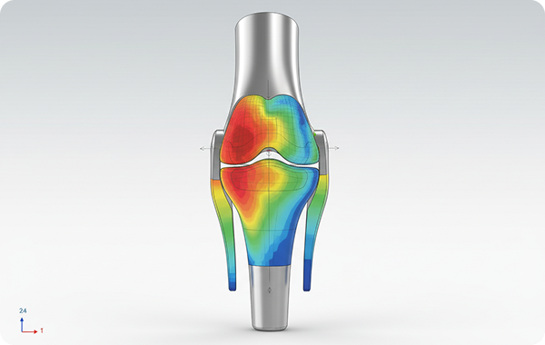 Finite element analysis of a medical knee implant