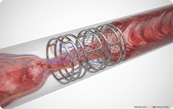 Medical Device Flow Analysis