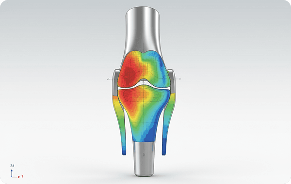 Biomechanics & Medical Device Simulation